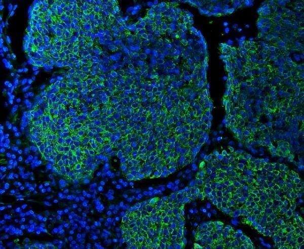 m00398 6 krt5 primary antibodies if testing 7
