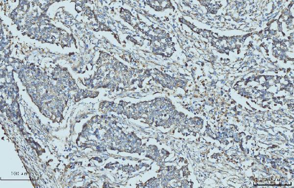  IHC analysis of Cytokeratin 5 using anti-Cytokeratin 5 antibody (M00398-6)