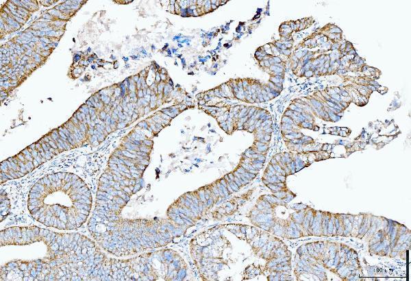  IHC analysis of Cytokeratin 5 using anti-Cytokeratin 5 antibody (M00398-6)
