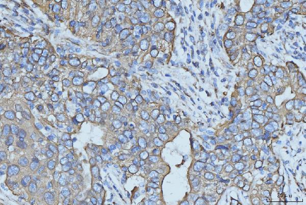 m00398 6 krt5 primary antibodies ihc testing 4