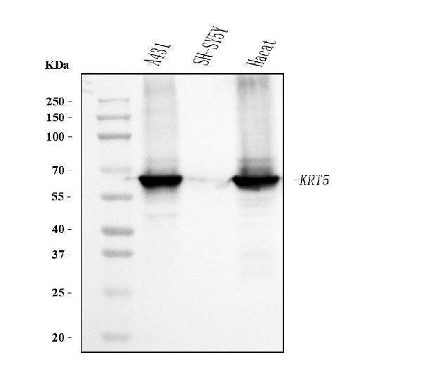  Western blot analysis of Cytokeratin 5 using anti-Cytokeratin 5 antibody (M00398-6)