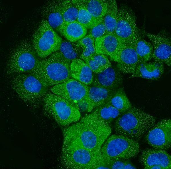 m00398 7 krt5 primary antibodies if testing 5