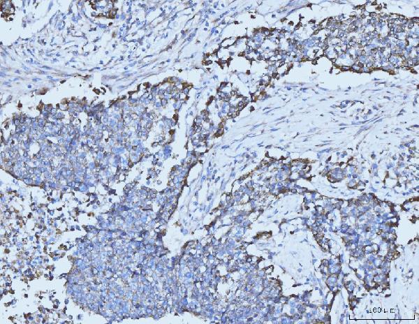  IHC analysis of Cytokeratin 5 using anti-Cytokeratin 5 antibody (M00398-7)