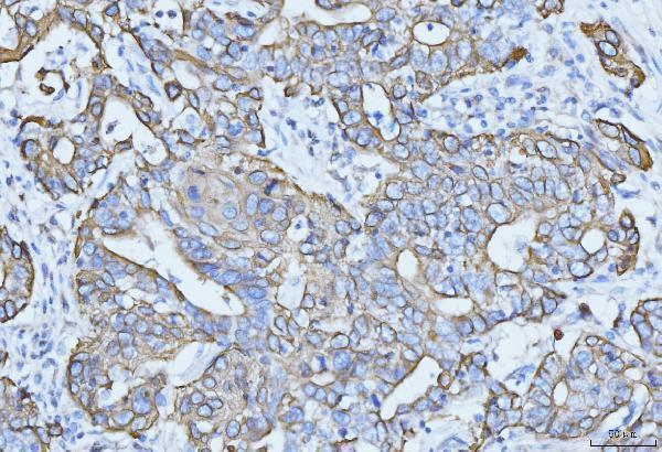  IHC analysis of Cytokeratin 5 using anti-Cytokeratin 5 antibody (M00398-7)