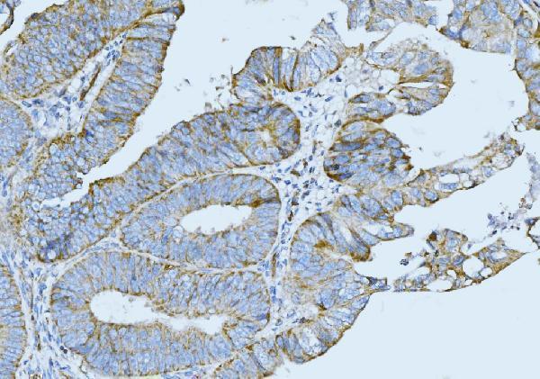 m00398 7 krt5 primary antibodies ihc testing 4