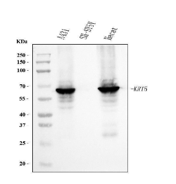  Western blot analysis of Cytokeratin 5 using anti-Cytokeratin 5 antibody (M00398-7)