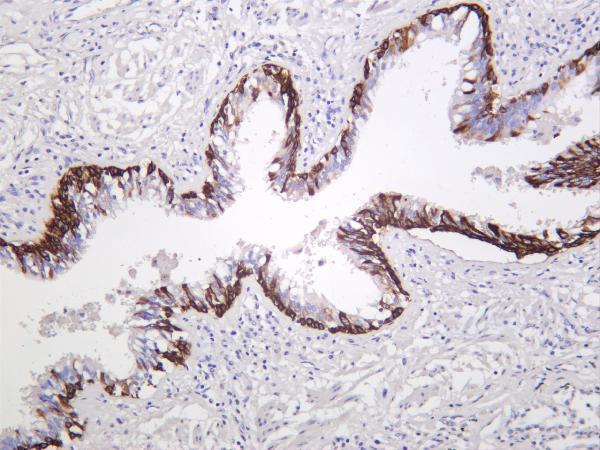 Human lung was stained with anti-Cytokeratin 5 rabbit antibody