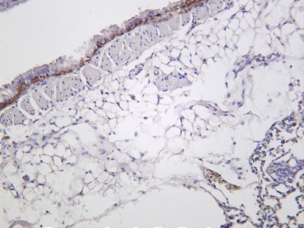 Mouse lung was stained with anti-Cytokeratin 5 rabbit antibody