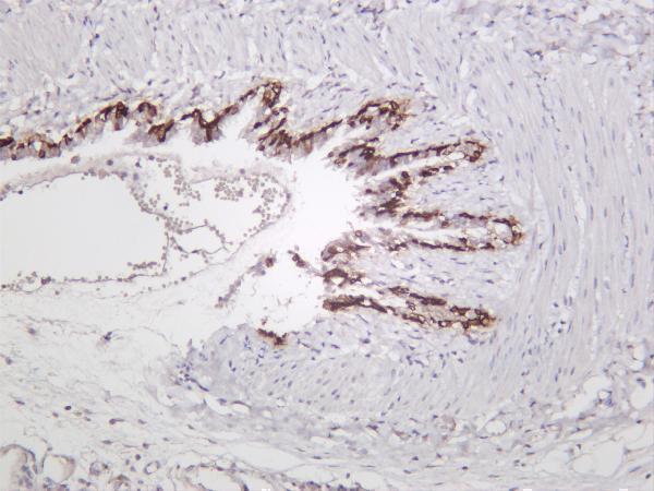 Rat lung was stained with anti-Cytokeratin 5 rabbit antibody