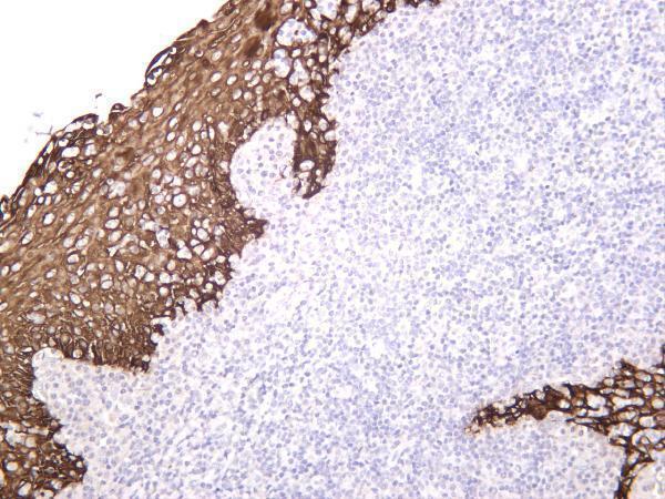 m00398 9 krt5 primary antibodies ihc testing 4
