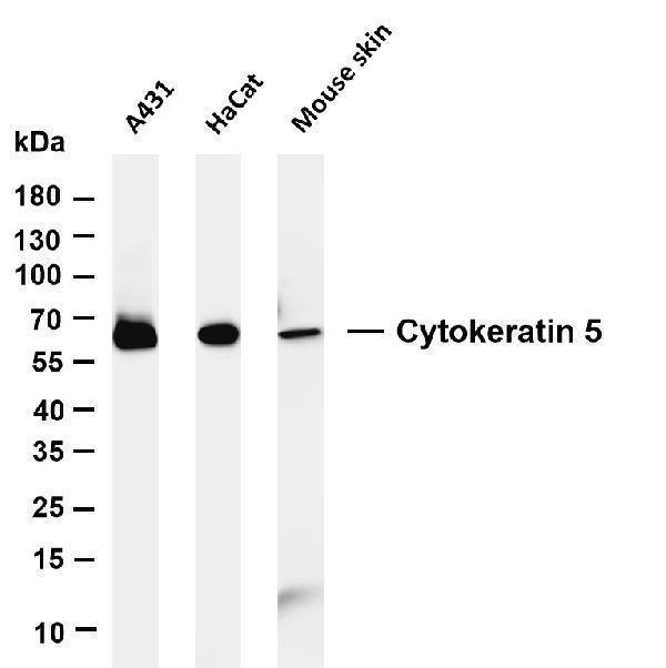 m00398 9 krt5 primary antibodies wb testing 5