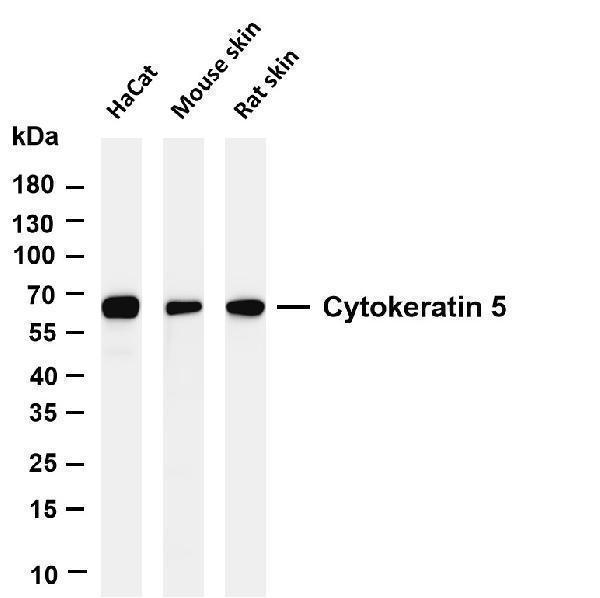 m00398 9 krt5 primary antibodies wb testing 6