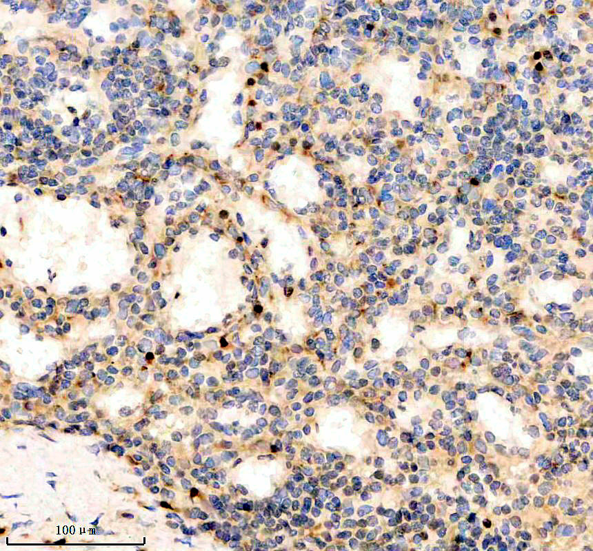 IHC analysis of MUM1 using anti-MUM1 antibody (M00401)