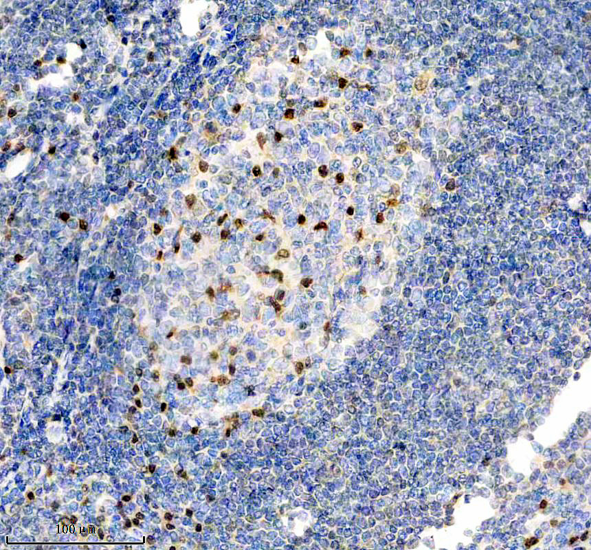 IHC analysis of MUM1 using anti-MUM1 antibody (M00401)