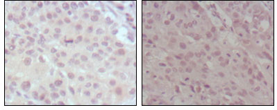 m00402 kmt2a primary antibodyes ihc testing 2