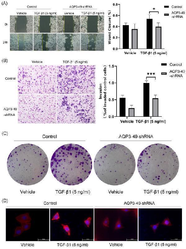 Knockdown of AQP3 attenuated the effects of NOX4-derived H 2 O 2 on migration, invasion, and proliferation of HeLa cells