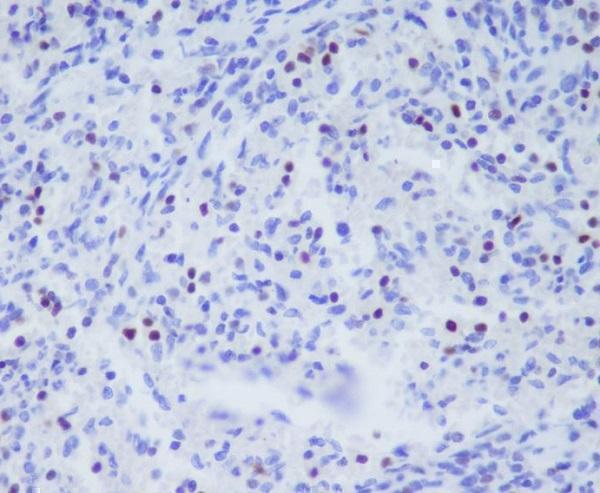 m00404 1 ihc