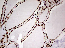 m00406 anti fbxw7 mouse monoclonal antibody clone id oti6f5 ihc testing 5