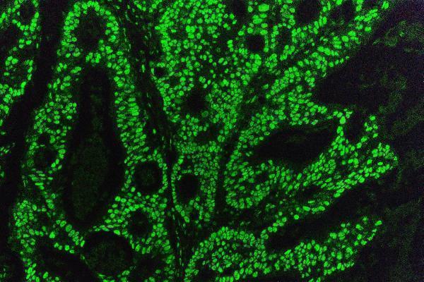 m00409 1 kap1 trim28 primary antibodies if testing 7