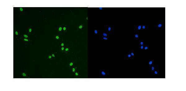 m00409 1 kap1 trim28 primary antibodies if testing 9