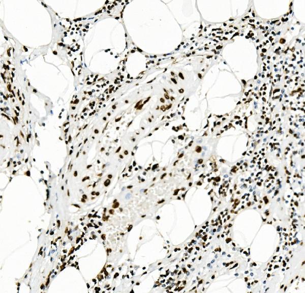  IHC analysis of KAP1/TRIM28 using anti-KAP1/TRIM28 antibody (M00409-1)