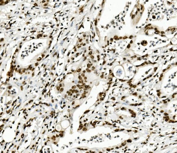  IHC analysis of KAP1/TRIM28 using anti-KAP1/TRIM28 antibody (M00409-1)