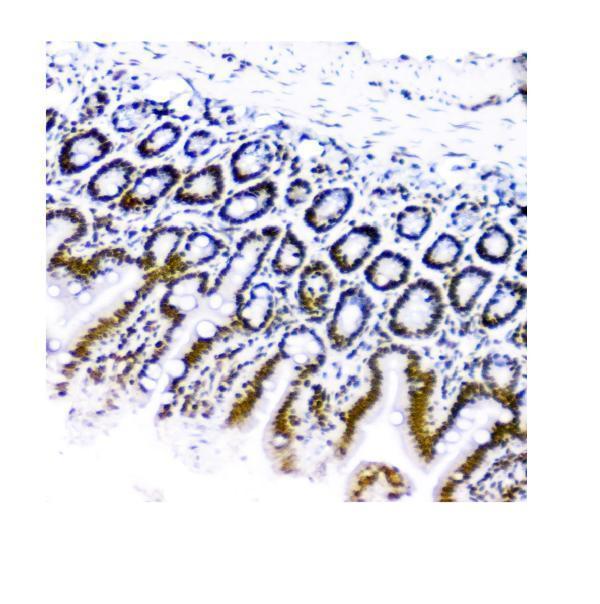 m00409 1 kap1 trim28 primary antibodies ihc testing 4