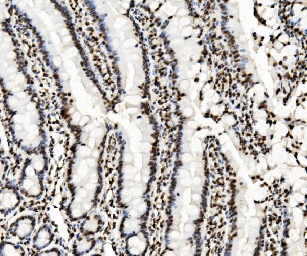 m00409 1 kap1 trim28 primary antibodies ihc testing 5