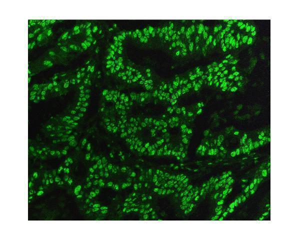 m00409 2 kap1 trim28 primary antibodies if testing 5