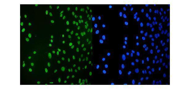 m00409 2 kap1 trim28 primary antibodies if testing 6