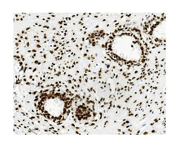  IHC analysis of KAP1/TRIM28 using anti-KAP1/TRIM28 antibody (M00409-2)