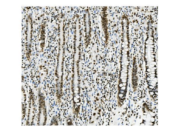  IHC analysis of KAP1/TRIM28 using anti-KAP1/TRIM28 antibody (M00409-2)