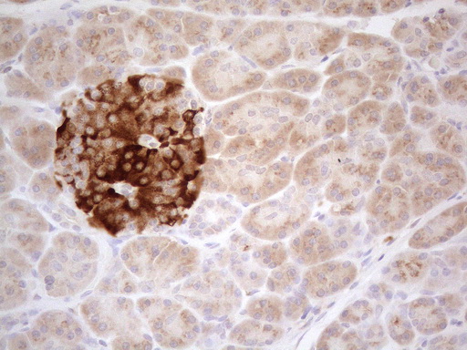 Immunohistochemical staining of paraffin-embedded Human pancreas tissue using anti-TNFRSF10B mouse monoclonal antibody