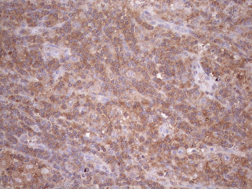 m00410 1 anti dr5 tnfrsf10b mouse monoclonal antibody clone id oti2a5 ihc testing 5