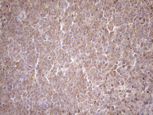 m00410 1 anti dr5 tnfrsf10b mouse monoclonal antibody clone id oti2a5 ihc testing 6