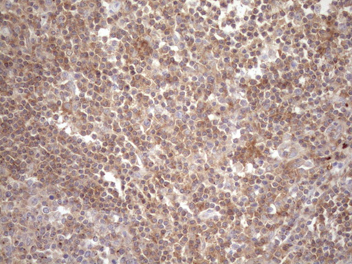 m00410 1 anti dr5 tnfrsf10b mouse monoclonal antibody clone id oti2a5 ihc testing 7