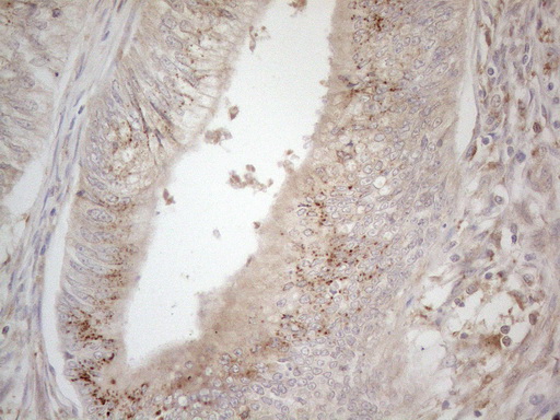 m00410 1 anti dr5 tnfrsf10b mouse monoclonal antibody clone id oti2a5 ihc testing 8