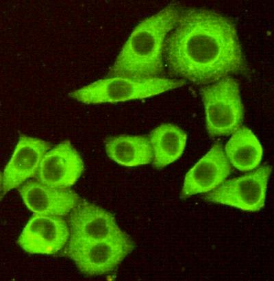 Immunocytochemistry of HeLa cells fixed by Paraformaldehyde and using anti-TNFRSF10B / DR5 antibody diluted 1:100
