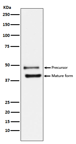 Western blot analysis of DR5 expression in HeLa cell lysate