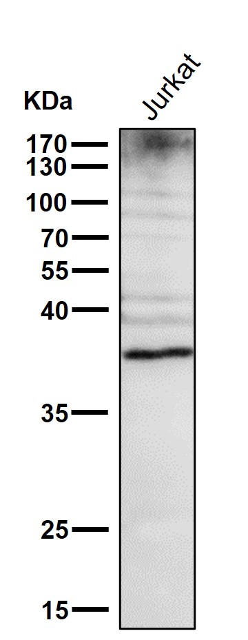 All lanes use the Antibody at 1:1W dilution for 1 hour at room temperature