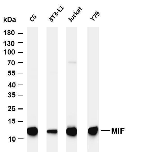 Various whole cell lysates were separated by 4-20% SDS-PAGE, and the membrane was blotted with anti-MIF antibody