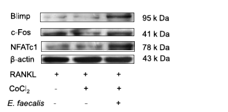 Western Blot analysis using Blimp-1 Monoclonal Antibody against Raji (1, 2), L1210 (3) and TPH-1 (4) cell lysate