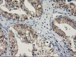 m00416 1 anti spr mouse monoclonal antibody clone id oti4f5 ihc testing 5