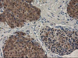 m00416 1 anti spr mouse monoclonal antibody clone id oti4f5 ihc testing 9
