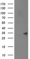 HEK293T cells were transfected with the pCMV6-ENTRY control (Left lane) or pCMV6-ENTRY SPR (Right lane) cDNA for 48 hrs and lysed