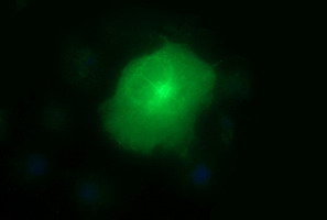 m00420 1 anti mmp13 mouse monoclonal antibody clone id oti2d8 if testing 9