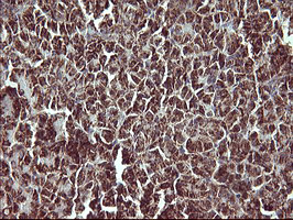 m00420 1 anti mmp13 mouse monoclonal antibody clone id oti2d8 ihc testing 3
