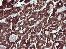 m00420 1 anti mmp13 mouse monoclonal antibody clone id oti2d8 ihc testing 4