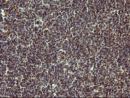 m00420 1 anti mmp13 mouse monoclonal antibody clone id oti2d8 ihc testing 6
