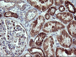 m00420 1 anti mmp13 mouse monoclonal antibody clone id oti2d8 ihc testing 7